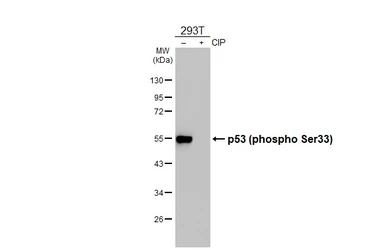 Anti-p53 (phospho Ser33) antibody [HL3559] used in Western Blot (WB). GTX641465