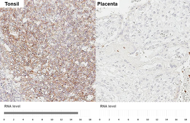 Anti-CXCR5 antibody [HL3569] used in IHC (Paraffin sections) (IHC-P). GTX641475