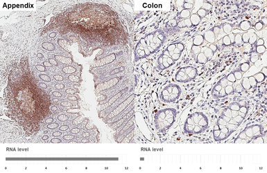 Anti-CXCR5 antibody [HL3569] used in IHC (Paraffin sections) (IHC-P). GTX641475