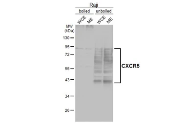 Anti-CXCR5 antibody [HL3569] used in Western Blot (WB). GTX641475