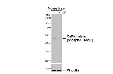 Anti-CaMKII alpha (phospho Thr286) antibody [HL3570] used in Western Blot (WB). GTX641517