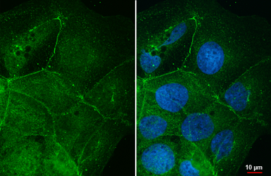 Anti-Desmocollin 2 antibody [HL3572] used in Immunocytochemistry/ Immunofluorescence (ICC/IF). GTX641543