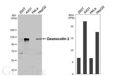 Anti-Desmocollin 2 antibody [HL3572] used in Western Blot (WB). GTX641543