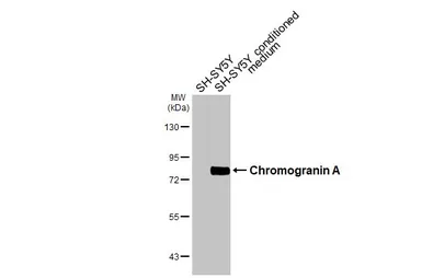 Anti-Chromogranin A antibody [HL3576] used in Western Blot (WB). GTX641547