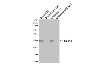 Anti-SYT13 antibody [HL3579] used in Western Blot (WB). GTX641550