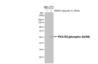 Anti-PKA R2 (phospho Ser99) antibody [HL3583] used in Western Blot (WB). GTX641554