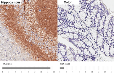 Anti-Neuroligin 3 antibody [HL3585] used in IHC (Paraffin sections) (IHC-P). GTX641556
