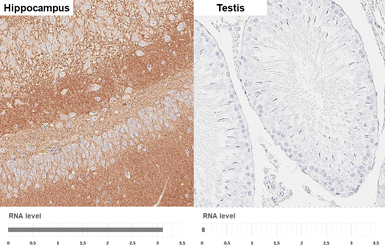 Anti-Neuroligin 3 antibody [HL3585] used in IHC (Paraffin sections) (IHC-P). GTX641556