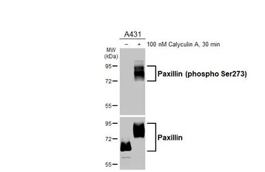 Anti-Paxillin (phospho Ser273) antibody [HL3588] used in Western Blot (WB). GTX641559