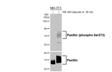 Anti-Paxillin (phospho Ser273) antibody [HL3588] used in Western Blot (WB). GTX641559