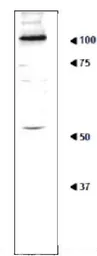 Anti-Ribophorin I (S. cerevisiae) antibody used in Western Blot (WB). GTX64156
