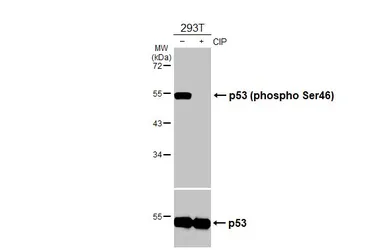 Anti-p53 (phospho Ser46) antibody [HL3589] used in Western Blot (WB). GTX641560