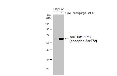Anti-SQSTM1 / P62 (phospho Ser272) antibody [HL3591] used in Western Blot (WB). GTX641562
