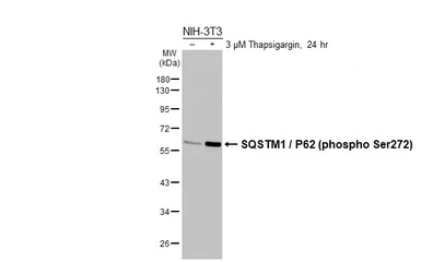 Anti-SQSTM1 / P62 (phospho Ser272) antibody [HL3591] used in Western Blot (WB). GTX641562