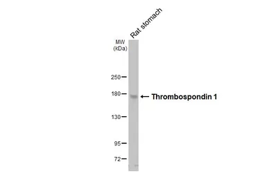 Anti-Thrombospondin 1 antibody [HL3593] used in Western Blot (WB). GTX641564