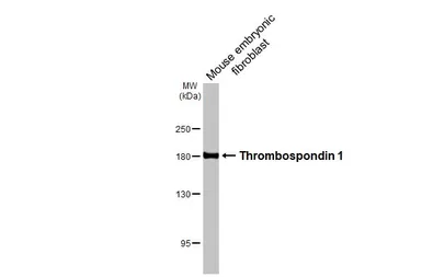 Anti-Thrombospondin 1 antibody [HL3593] used in Western Blot (WB). GTX641564