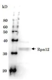 Anti-Rpn12 (S. cerevisiae) antibody used in Western Blot (WB). GTX64157