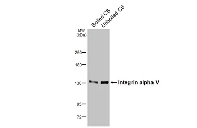 Anti-Integrin alpha V antibody [HL3598] used in Western Blot (WB). GTX641573