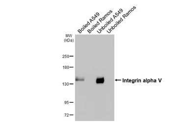 Anti-Integrin alpha V antibody [HL3598] used in Western Blot (WB). GTX641573