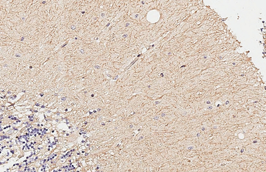 Anti-Integrin alpha V antibody [HL3598] used in IHC (Paraffin sections) (IHC-P). GTX641573