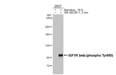 Anti-IGF1R beta (phospho Tyr950) antibody [HL3607] used in Western Blot (WB). GTX641582