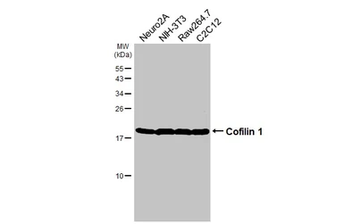 Anti-Cofilin 1 antibody [HL3609] used in Western Blot (WB). GTX641584