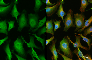 Anti-Cofilin 1 antibody [HL3609] used in Immunocytochemistry/ Immunofluorescence (ICC/IF). GTX641584