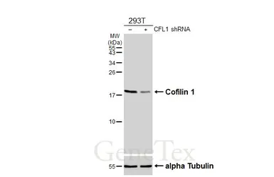 Anti-Cofilin 1 antibody [HL3609] used in Western Blot (WB). GTX641584