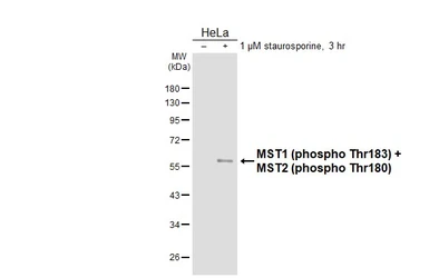 Anti-MST1 (phospho Thr183) + MST2 (phospho Thr180) antibody [HL3610] used in Western Blot (WB). GTX641585