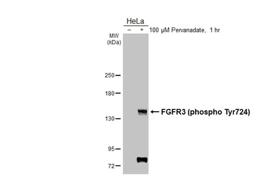 Anti-FGFR3 (phospho Tyr724) antibody [HL3612] used in Western Blot (WB). GTX641587