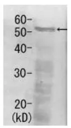 Anti-Rpn5 (S. cerevisiae) antibody used in Western Blot (WB). GTX64159