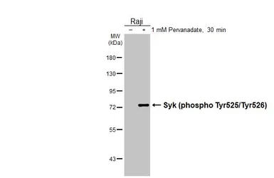Anti-Syk (phospho Tyr525/Tyr526) antibody [HL3616] used in Western Blot (WB). GTX641591