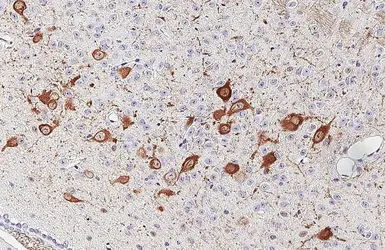 Anti-Choline Acetyltransferase antibody [HL3617] used in IHC (Paraffin sections) (IHC-P). GTX641592