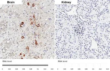 Anti-Choline Acetyltransferase antibody [HL3617] used in IHC (Paraffin sections) (IHC-P). GTX641592