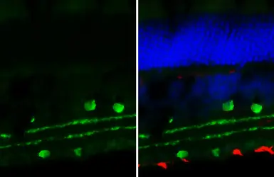 Anti-Choline Acetyltransferase antibody [HL3617] used in IHC (Frozen sections) (IHC-Fr). GTX641592