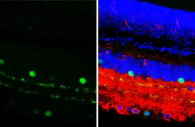 Anti-Choline Acetyltransferase antibody [HL3617] used in IHC (Paraffin sections) (IHC-P). GTX641592