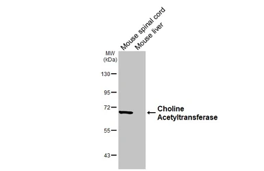 Anti-Choline Acetyltransferase antibody [HL3617] used in Western Blot (WB). GTX641592