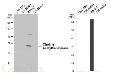 Anti-Choline Acetyltransferase antibody [HL3617] used in Western Blot (WB). GTX641592