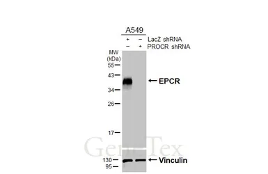 Anti-EPCR antibody [HL3619] used in Western Blot (WB). GTX641594