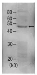 Anti-Rpn7 (S. cerevisiae) antibody used in Western Blot (WB). GTX64160