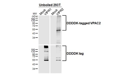 Anti-VPAC2 antibody [HL3625] used in Western Blot (WB). GTX641600