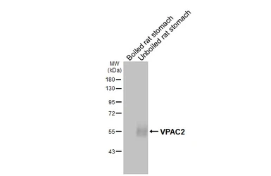 Anti-VPAC2 antibody [HL3625] used in Western Blot (WB). GTX641600