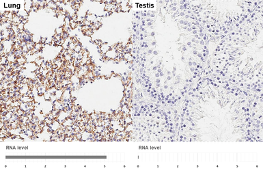 Anti-VPAC2 antibody [HL3625] used in IHC (Paraffin sections) (IHC-P). GTX641600