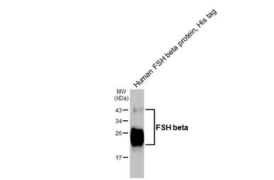 Anti-FSH beta antibody [GT64] used in Western Blot (WB). GTX641602
