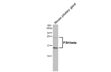 Anti-FSH beta antibody [GT64] used in Western Blot (WB). GTX641602