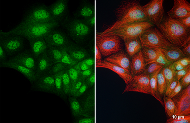 Anti-Rad51 antibody [HL3628] used in Immunocytochemistry/ Immunofluorescence (ICC/IF). GTX641619