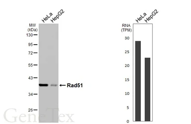 Anti-Rad51 antibody [HL3628] used in Western Blot (WB). GTX641619