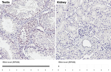Anti-Rad51 antibody [HL3628] used in IHC (Paraffin sections) (IHC-P). GTX641619