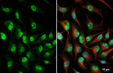 Anti-Rb antibody [HL3631] used in Immunocytochemistry/ Immunofluorescence (ICC/IF). GTX641622