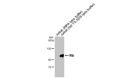 Anti-Rb antibody [HL3631] used in Western Blot (WB). GTX641622